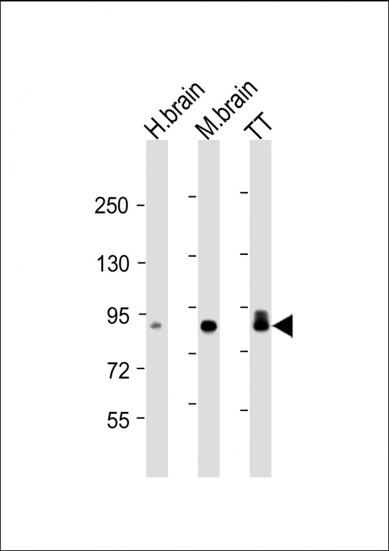 DCLK / DCLK1 Antibody - All lanes: Anti-DCLK1 Antibody at 1:4000 dilution Lane 1: human brain lysate Lane 2: mouse brain lysate Lane 3: TT whole cell lysate Lysates/proteins at 20 µg per lane. Secondary Goat Anti-mouse IgG, (H+L), Peroxidase conjugated at 1/10000 dilution. Predicted band size: 82 kDa Blocking/Dilution buffer: 5% NFDM/TBST.