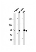 DCLK / DCLK1 Antibody - All lanes: Anti-DCLK1 Antibody at 1:4000 dilution Lane 1: human brain lysate Lane 2: mouse brain lysate Lane 3: TT whole cell lysate Lysates/proteins at 20 µg per lane. Secondary Goat Anti-mouse IgG, (H+L), Peroxidase conjugated at 1/10000 dilution. Predicted band size: 82 kDa Blocking/Dilution buffer: 5% NFDM/TBST.