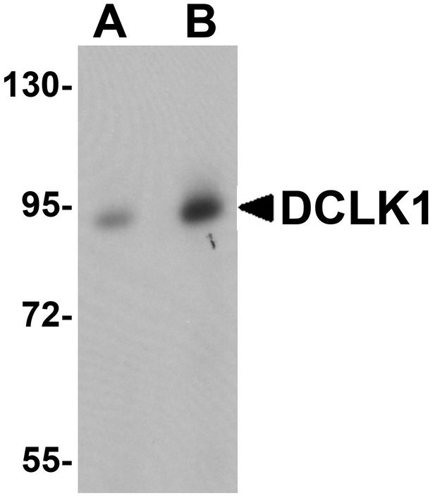 DCLK / DCLK1 Antibody - Western blot analysis of DCLK1 in human brain tissue lysate with DCLK1 antibody at (A) 0.5 and (B) 1 ug/ml.