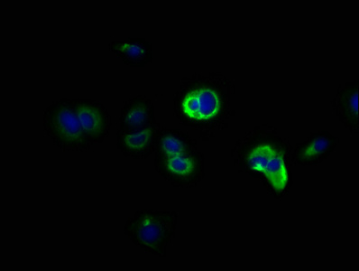 DCLK / DCLK1 Antibody - Immunofluorescence staining of MCF-7 cells with DCLK1 Antibody at 1:166, counter-stained with DAPI. The cells were fixed in 4% formaldehyde, permeabilized using 0.2% Triton X-100 and blocked in 10% normal Goat Serum. The cells were then incubated with the antibody overnight at 4°C. The secondary antibody was Alexa Fluor 488-congugated AffiniPure Goat Anti-Rabbit IgG(H+L).