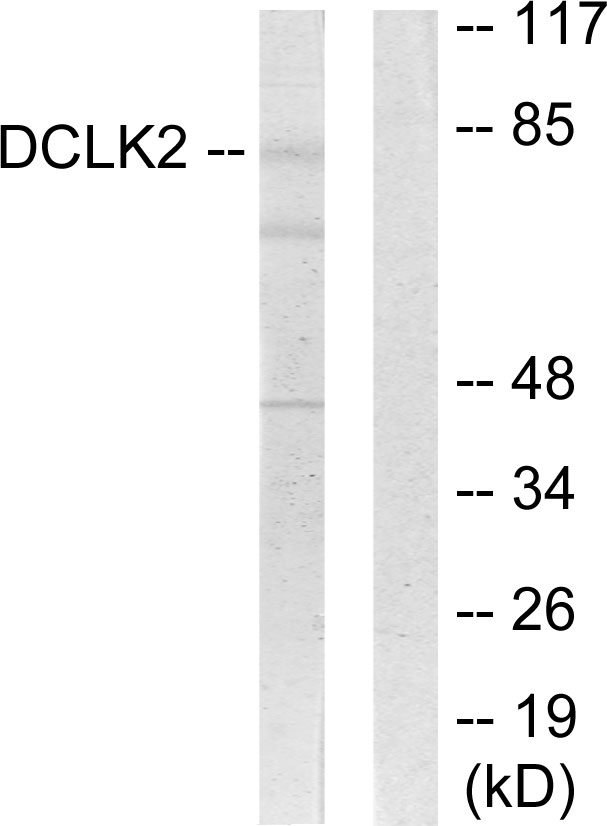 DCLK2 / DCAMKL2 Antibody - Western blot analysis of lysates from HepG2 cells, using DCLK2 Antibody. The lane on the right is blocked with the synthesized peptide.