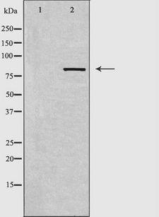 DCLK2 / DCAMKL2 Antibody - Western blot analysis of extracts of HepG2 cells using DCLK2 antibody. The lane on the left is treated with the antigen-specific peptide.
