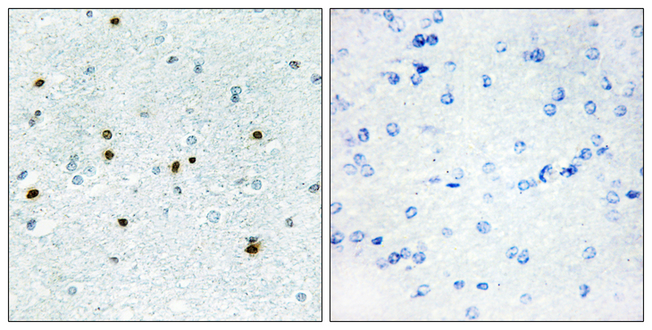 DCLK3 / CLR Antibody - Immunohistochemistry analysis of paraffin-embedded human brain, using DCLK3 Antibody. The picture on the right is blocked with the synthesized peptide.