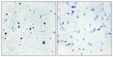 DCLK3 / CLR Antibody - Immunohistochemistry analysis of paraffin-embedded human brain, using DCLK3 Antibody. The picture on the right is blocked with the synthesized peptide.