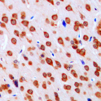 DCLK3 / CLR Antibody - Immunohistochemical analysis of DCLK3 staining in human brain formalin fixed paraffin embedded tissue section. The section was pre-treated using heat mediated antigen retrieval with sodium citrate buffer (pH 6.0). The section was then incubated with the antibody at room temperature and detected using an HRP conjugated compact polymer system. DAB was used as the chromogen. The section was then counterstained with hematoxylin and mounted with DPX.