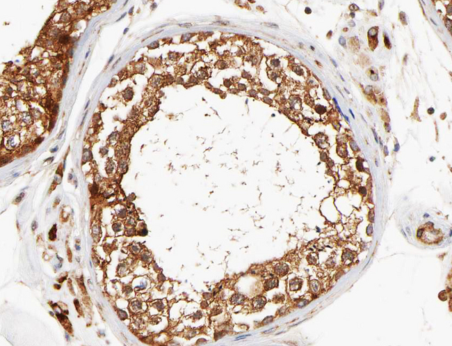 DCLK3 / CLR Antibody - 1:100 staining human Testis tissue by IHC-P. The tissue was formaldehyde fixed and a heat mediated antigen retrieval step in citrate buffer was performed. The tissue was then blocked and incubated with the antibody for 1.5 hours at 22°C. An HRP conjugated goat anti-rabbit antibody was used as the secondary.