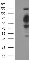 DCLRE1B Antibody - HEK293T cells were transfected with the pCMV6-ENTRY control (Left lane) or pCMV6-ENTRY DCLRE1B (Right lane) cDNA for 48 hrs and lysed. Equivalent amounts of cell lysates (5 ug per lane) were separated by SDS-PAGE and immunoblotted with anti-DCLRE1B.
