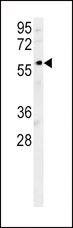 DCLRE1B Antibody - DCLRE1B Antibody western blot of mouse kidney tissue lysates (35 ug/lane). The DCLRE1B antibody detected DCLRE1B protein (arrow).
