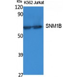 DCLRE1B Antibody - Western blot of SNM1B antibody