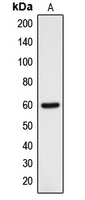 DCLRE1B Antibody - Western blot analysis of DCLRE1B expression in HOS (A) whole cell lysates.