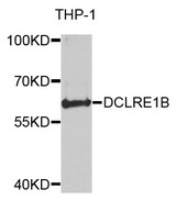 DCLRE1B Antibody - Western blot analysis of extracts of THP-1 cells.