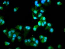 DCLRE1B Antibody - Immunofluorescence staining of MCF-7 cells diluted at 1:66, counter-stained with DAPI. The cells were fixed in 4% formaldehyde, permeabilized using 0.2% Triton X-100 and blocked in 10% normal Goat Serum. The cells were then incubated with the antibody overnight at 4°C.The Secondary antibody was Alexa Fluor 488-congugated AffiniPure Goat Anti-Rabbit IgG (H+L).