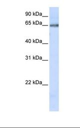 DCLRE1C / Artemis Antibody - 293T cell lysate. Antibody concentration: 1.0 ug/ml. Gel concentration: 12%.  This image was taken for the unconjugated form of this product. Other forms have not been tested.
