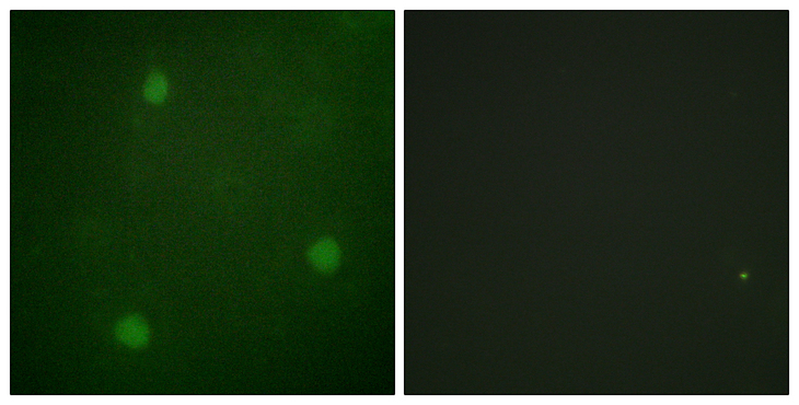DCLRE1C / Artemis Antibody - Immunofluorescence analysis of NIH/3T3 cells, using Artemis Antibody. The picture on the right is blocked with the synthesized peptide.