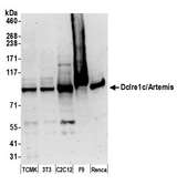 DCLRE1C / Artemis Antibody - Detection of mouse Dclre1c/Artemis by western blot. Samples: Whole cell lysate (50 µg) from TCMK-1, NIH 3T3, C2C12, F9, and Renca cells prepared using NETN lysis buffer. Antibody: Affinity purified rabbit anti-Dclre1c/Artemis antibody used for WB at 0.1 µg/ml. Detection: Chemiluminescence with an exposure time of 3 minutes.
