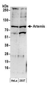 DCLRE1C / Artemis Antibody - Detection of human Artemis by western blot. Samples: Whole cell lysate (50 µg) from HeLa and HEK293T cells prepared using NETN lysis buffer. Antibody: Affinity purified rabbit anti-Artemis antibody used for WB at 1 µg/ml. Detection: Chemiluminescence with an exposure time of 3 minutes.