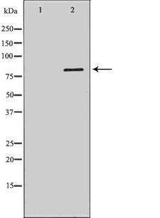 DCLRE1C / Artemis Antibody - Western blot analysis of HeLa whole cells lysates using DCLRE1C antibody. The lane on the left is treated with the antigen-specific peptide.