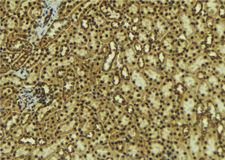 DCLRE1C / Artemis Antibody - 1:100 staining mouse kidney tissue by IHC-P. The sample was formaldehyde fixed and a heat mediated antigen retrieval step in citrate buffer was performed. The sample was then blocked and incubated with the antibody for 1.5 hours at 22°C. An HRP conjugated goat anti-rabbit antibody was used as the secondary.