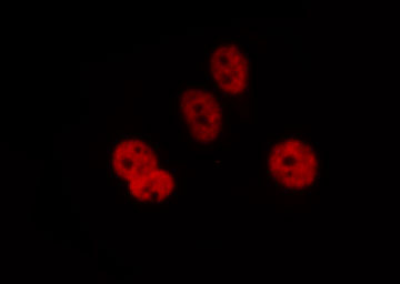 DCLRE1C / Artemis Antibody - Staining HepG2 cells by IF/ICC. The samples were fixed with PFA and permeabilized in 0.1% Triton X-100, then blocked in 10% serum for 45 min at 25°C. The primary antibody was diluted at 1:200 and incubated with the sample for 1 hour at 37°C. An Alexa Fluor 594 conjugated goat anti-rabbit IgG (H+L) Ab, diluted at 1/600, was used as the secondary antibody.
