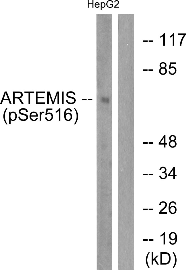 DCLRE1C / Artemis Antibody - Western blot analysis of lysates from HepG2 cells treated with EGF 200ng/ml 30', using Artemis (Phospho-Ser516) Antibody. The lane on the right is blocked with the phospho peptide.