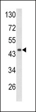 DCN / Decorin Antibody - Western blot of DCN antibody in mouse heart tissue lysates (35 ug/lane). DCN (arrow) was detected using the purified antibody.