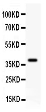 DCN / Decorin Antibody - Decorin antibody Western blot. All lanes: Anti Decorin at 0.5 ug/ml. WB: Recombinant Human Decorin Protein 0.5ng. Predicted band size: 38 kD. Observed band size: 38 kD.
