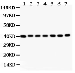 DCN / Decorin Antibody - Decorin antibody Western blot. All lanes: Anti Decorin at 0.5 ug/ml. Lane 1: Rat Liver Tissue Lysate at 50 ug. Lane 2: Rat Kidney Tissue Lysate at 50 ug. Lane 3: Rat Spleen Tissue Lysate at 50 ug. Lane 4: Rat Lung Tissue Lysate at 50 ug. Lane 5: MCF-7 Whole Cell Lysate at 40 ug. Lane 6: SW620 Whole Cell Lysate at 40 ug. Lane 7: Hepg2 Whole Cell Lysate at 40 ug. Predicted band size: 40 kD. Observed band size: 40 kD.