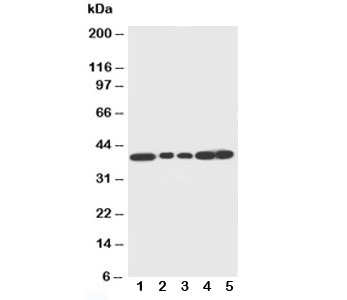 DCN / Decorin Antibody - Western blot testing of Decorin antibody and Lane 1: rat liver; 2: rat lung; 3: rat spleen; 4: SMMC-7721 cell lysate (50ug); 5: SMMC-7721 cell lysate (40ug)