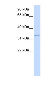 DCN / Decorin Antibody - DCN / Decorin antibody Western blot of Placenta lysate. This image was taken for the unconjugated form of this product. Other forms have not been tested.