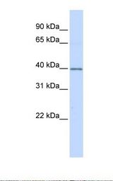 DCN / Decorin Antibody - Fetal heart lysate. Antibody concentration: 1.0 ug/ml. Gel concentration: 12%.  This image was taken for the unconjugated form of this product. Other forms have not been tested.