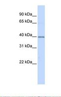 DCN / Decorin Antibody - Fetal heart lysate. Antibody concentration: 1.0 ug/ml. Gel concentration: 12%.  This image was taken for the unconjugated form of this product. Other forms have not been tested.