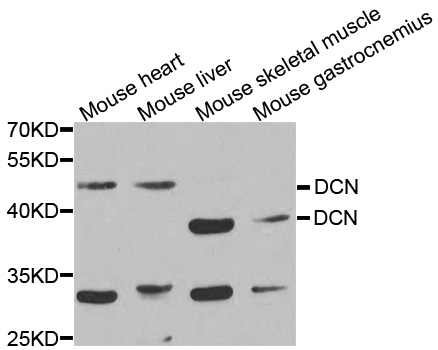 DCN / Decorin Antibody - Western blot analysis of extracts of various cell lines.