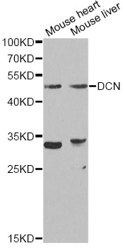 DCN / Decorin Antibody - Western blot analysis of extracts of various cell lines, using DCN antibody at 1:1000 dilution. The secondary antibody used was an HRP Goat Anti-Rabbit IgG (H+L) at 1:10000 dilution. Lysates were loaded 25ug per lane and 3% nonfat dry milk in TBST was used for blocking. An ECL Kit was used for detection.
