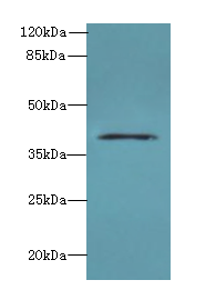 DCN / Decorin Antibody - Western blot. All lanes: DCN antibody at 6 ug/ml+Jurkag- whole cell lysate Goat polyclonal to rabbit at 1:10000 dilution. Predicted band size: 40 kDa. Observed band size: 40 kDa.