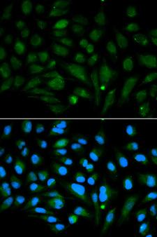 DCN / Decorin Antibody - Immunofluorescence analysis of MCF-7 cells using Decorin Polyclonal Antibody.