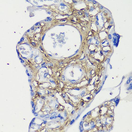 DCN / Decorin Antibody - Immunohistochemistry of paraffin-embedded Human placenta using Decorin Polyclonal Antibody at dilution of 1:200 (40x lens).