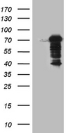 DCP1B Antibody - HEK293T cells were transfected with the pCMV6-ENTRY control. (Left lane) or pCMV6-ENTRY DCP1B. (Right lane) cDNA for 48 hrs and lysed. Equivalent amounts of cell lysates. (5 ug per lane) were separated by SDS-PAGE and immunoblotted with anti-DCP1B. (1:2000)