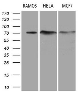 DCP1B Antibody - Western blot analysis of extracts. (35ug) from 3 different cell lines by using anti-DCP1B monoclonal antibody. (1:500)