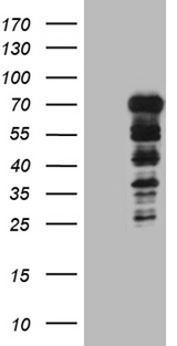 DCP1B Antibody - HEK293T cells were transfected with the pCMV6-ENTRY control. (Left lane) or pCMV6-ENTRY DCP1B. (Right lane) cDNA for 48 hrs and lysed. Equivalent amounts of cell lysates. (5 ug per lane) were separated by SDS-PAGE and immunoblotted with anti-DCP1B. (1:2000)