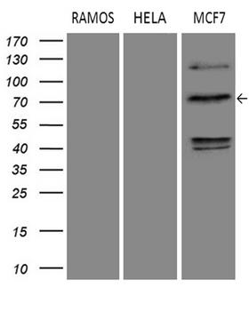 DCP1B Antibody - Western blot analysis of extracts. (35ug) from 3 different cell lines by using anti-DCP1B monoclonal antibody. (1:500)
