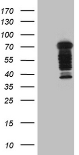 DCP1B Antibody - HEK293T cells were transfected with the pCMV6-ENTRY control. (Left lane) or pCMV6-ENTRY DCP1B. (Right lane) cDNA for 48 hrs and lysed. Equivalent amounts of cell lysates. (5 ug per lane) were separated by SDS-PAGE and immunoblotted with anti-DCP1B. (1:2000)