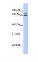 DCP1B Antibody - 721_B cell lysate. Antibody concentration: 1.0 ug/ml. Gel concentration: 12%.  This image was taken for the unconjugated form of this product. Other forms have not been tested.