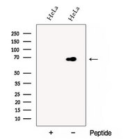 DCP1B Antibody - Western blot analysis of extracts of 293T cells using DCP1B antibody. The lane on the left was treated with blocking peptide.