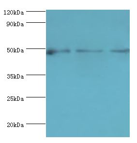 DCP2 Antibody - Western blot. All lanes: m7GpppN-mRNA hydrolase antibody at 7 ug/ml. Lane 1: HeLa whole cell lysate. Lane 2: Jurkat whole cell lysate. Lane 3: 293T whole cell lysate. secondary Goat polyclonal to rabbit at 1:10000 dilution. Predicted band size: 48 kDa. Observed band size: 48 kDa.