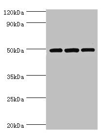 DCP2 Antibody - Western blot All lanes: m7GpppN-mRNA hydrolase antibody at 7µg/ml Lane 1: Hela whole cell lysate Lane 2: Jurkat whole cell lysate Lane 3: 293T whole cell lysate Secondary Goat polyclonal to rabbit IgG at 1/10000 dilution Predicted band size: 49, 45 kDa Observed band size: 49 kDa