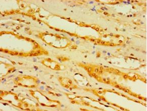DCP2 Antibody - Immunohistochemistry of paraffin-embedded human kidney tissue using antibody at 1:100 dilution.  This image was taken for the unconjugated form of this product. Other forms have not been tested.