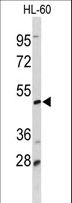 DCP2 Antibody - Western blot of DCP2 Antibody in HL-60 cell line lysates (35 ug/lane). DCP2 (arrow) was detected using the purified antibody.