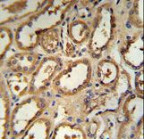 DCP2 Antibody - DCP2 Antibody IHC of formalin-fixed and paraffin-embedded human kidney tissue followed by peroxidase-conjugated secondary antibody and DAB staining.