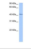 DCP2 Antibody - Jurkat cell lysate. Antibody concentration: 0.5 ug/ml. Gel concentration: 12%.  This image was taken for the unconjugated form of this product. Other forms have not been tested.