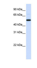 DCP2 Antibody - DCP2 antibody Western blot of Placenta lysate. This image was taken for the unconjugated form of this product. Other forms have not been tested.